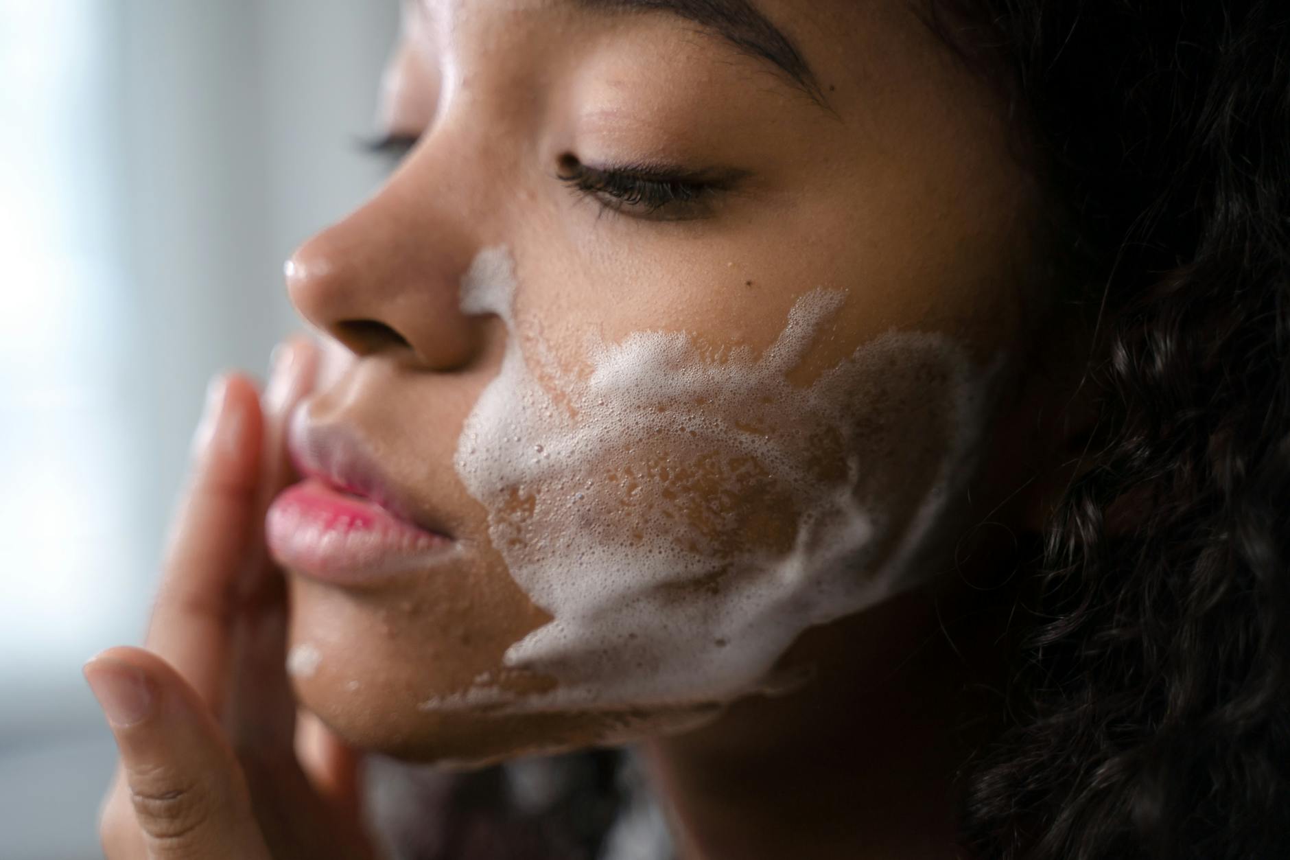 What Gets Mistaken for Rosacea? A Dermatologist''s Guide to Look-Alike Skin Conditions