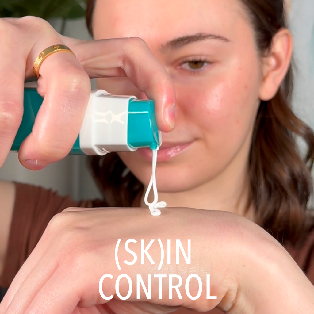 90-Day Acne Kit