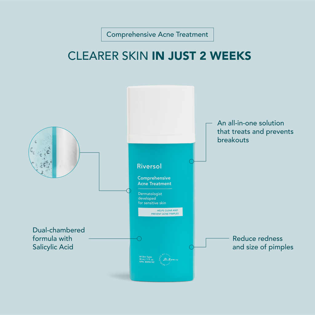 90-Day Acne Kit
