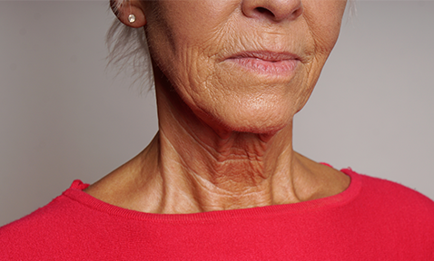 Embracing Our Aging Necks: Overcoming