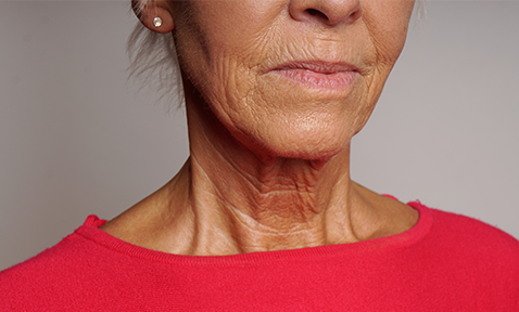 Embracing Our Aging Necks: Overcoming Insecurities