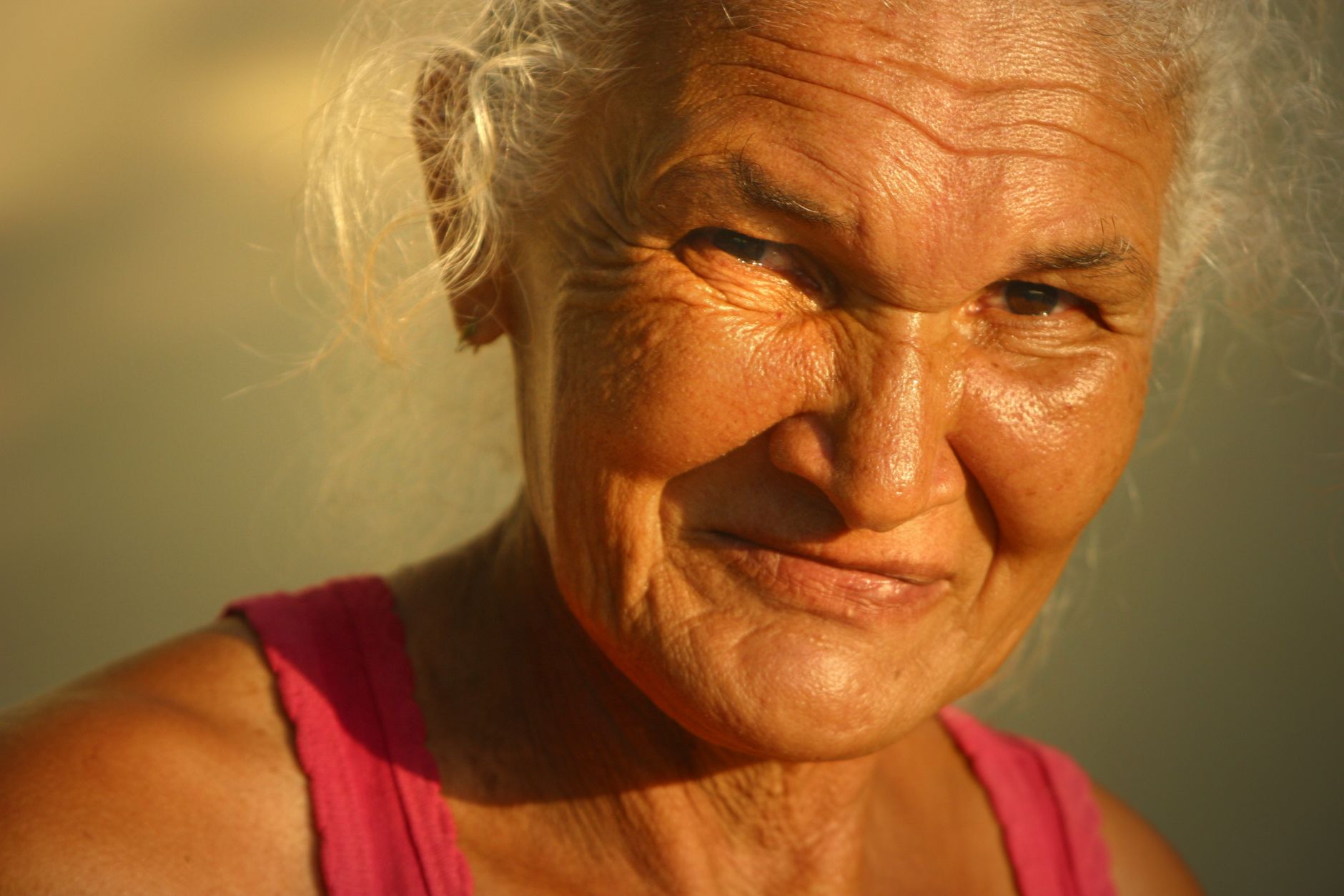 What Are the Disadvantages of Retinol?