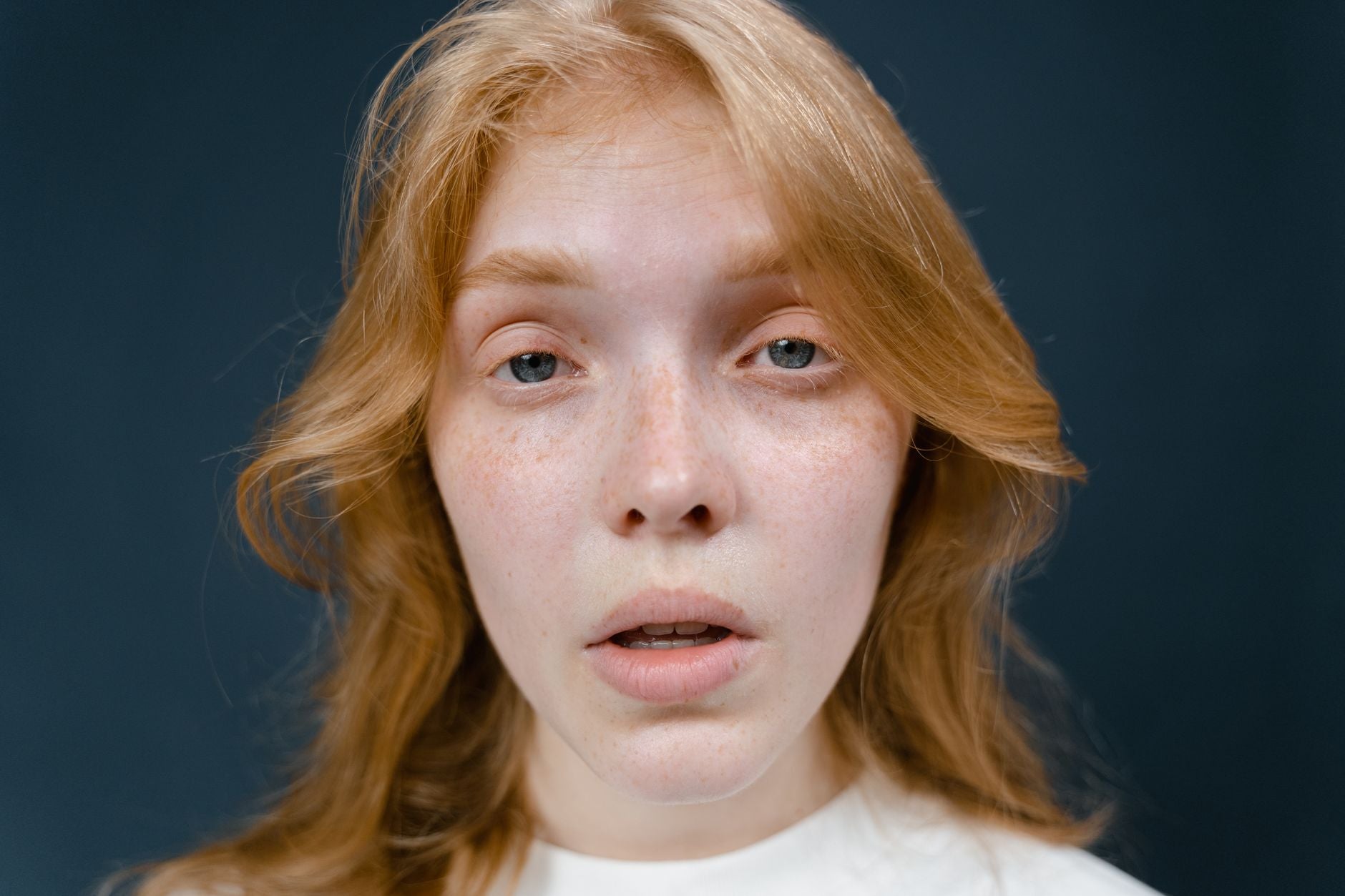 Which Face Serum Is Best for Rosacea