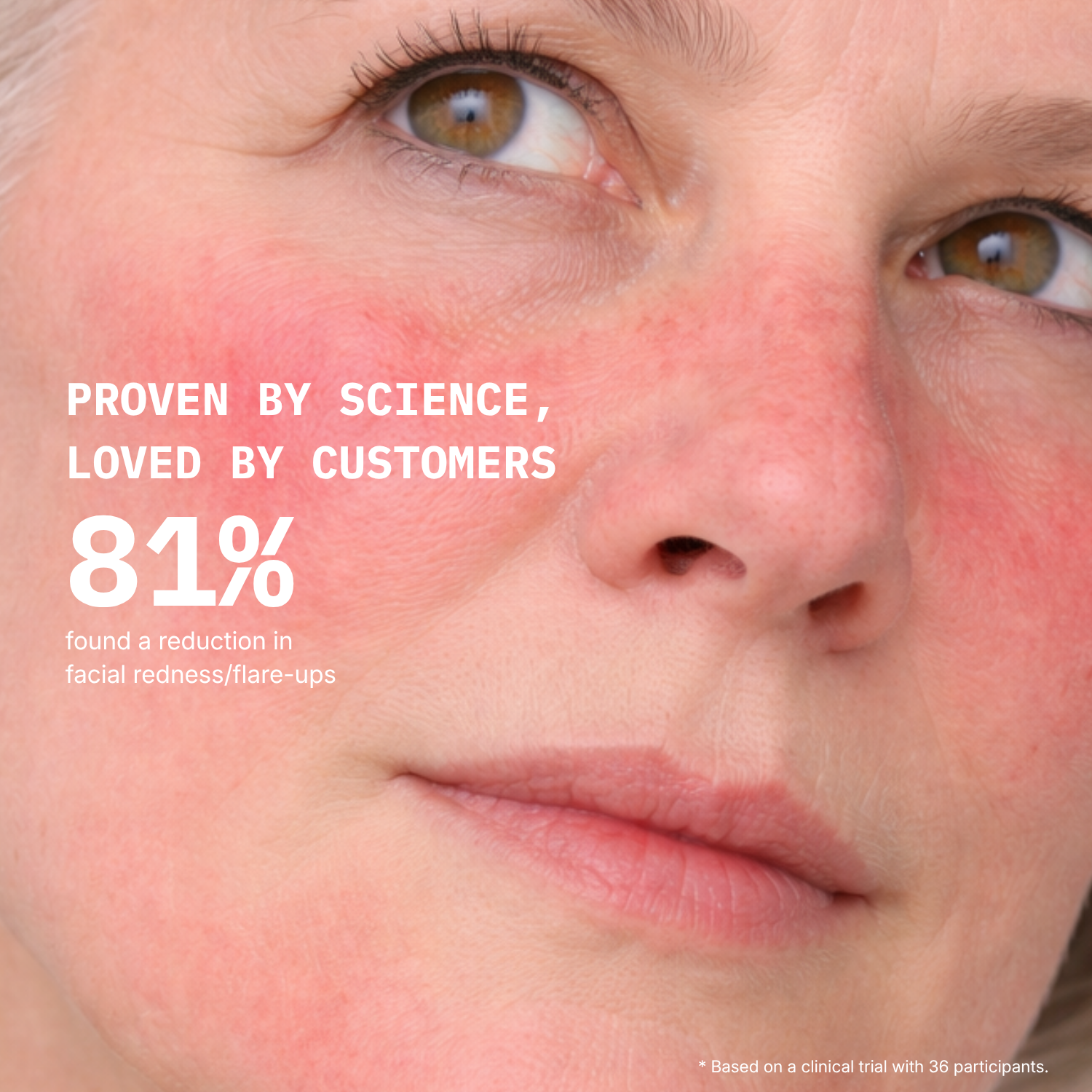 Redness Calming Mask