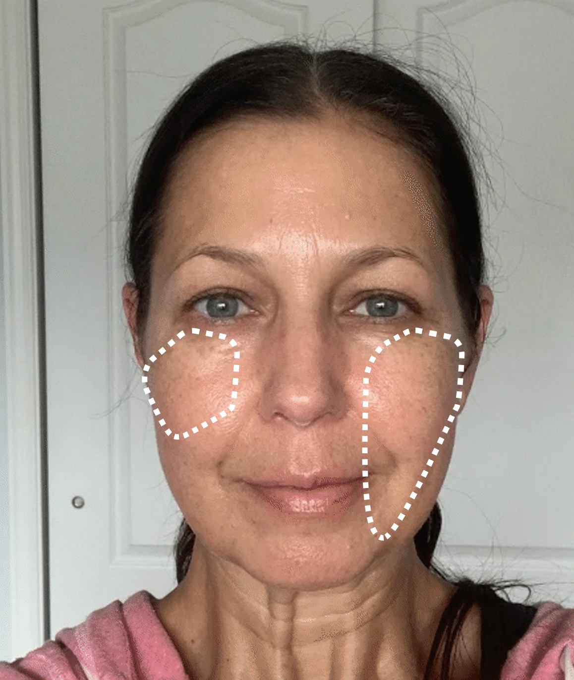 Aging