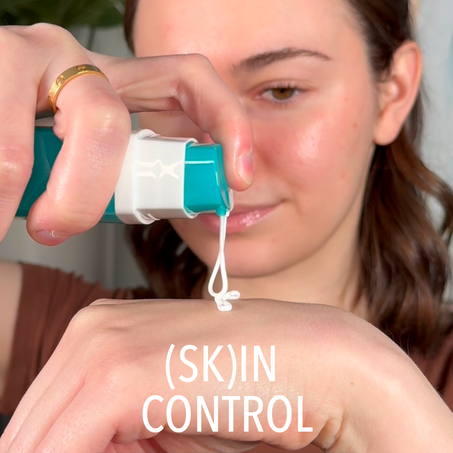 90-Day Acne Kit