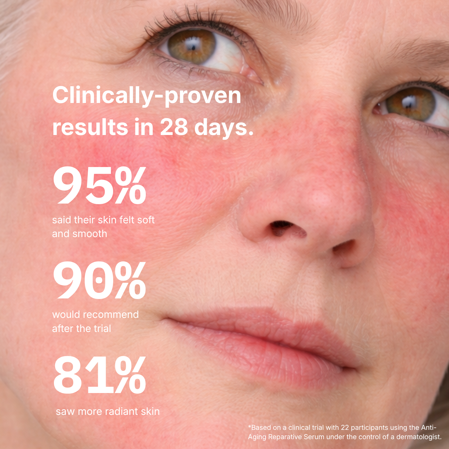 Anti-Redness Serum (30mL)