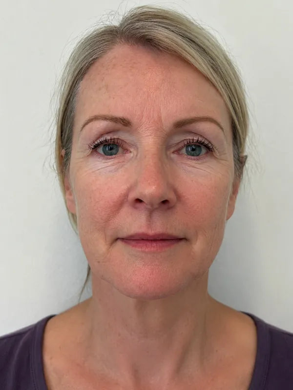 Before using Riversol Anti-Aging Serum