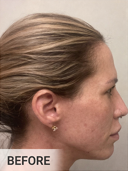 Before using Riversol Anti-Aging Trio
