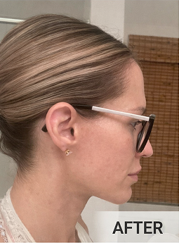 After using Riversol Anti-Aging Trio