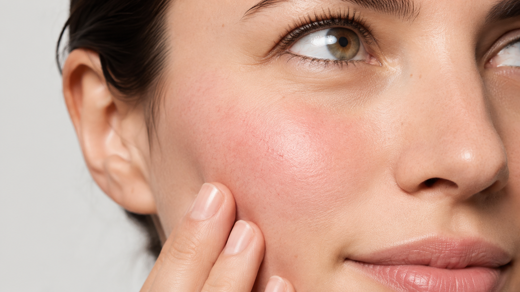 Close-up of woman with mild facial redness