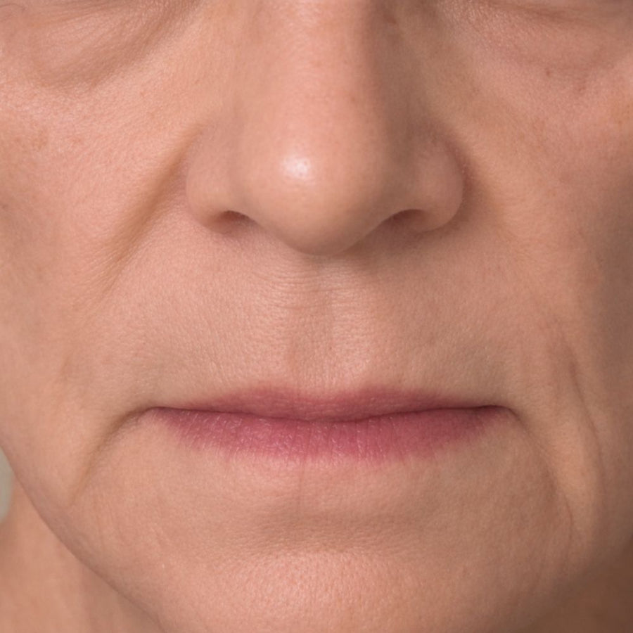 After 12 weeks of use — softer texture, faded age spots