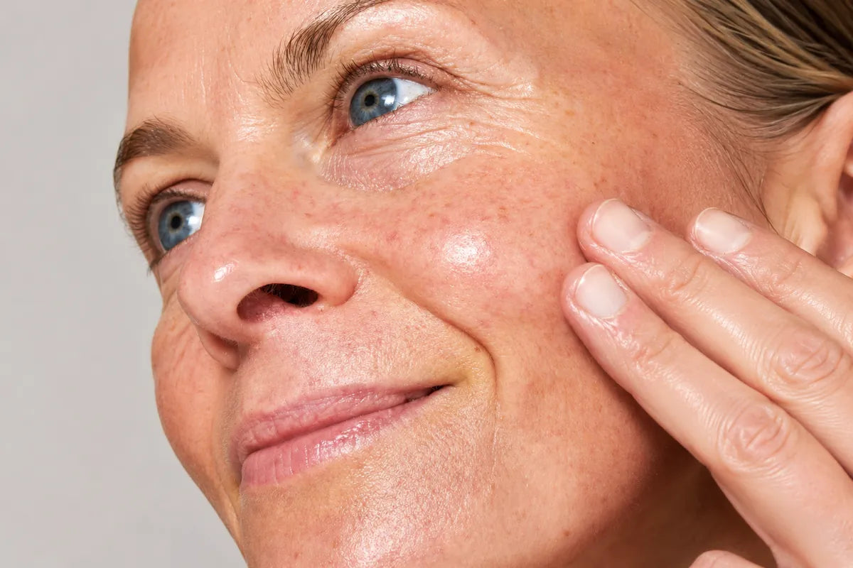 Close-up of a woman with visible redness touching her cheek